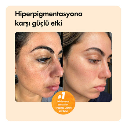 Diamond Glow™ – Kojik Asit Temizleme Sabunu Temizleme Barı