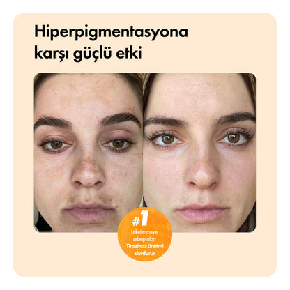 Diamond Glow™ – Kojik Asit Temizleme Sabunu Temizleme Barı