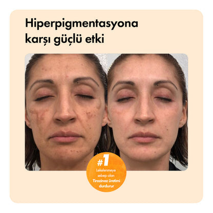 Diamond Glow™ – Kojik Asit Temizleme Sabunu Temizleme Barı